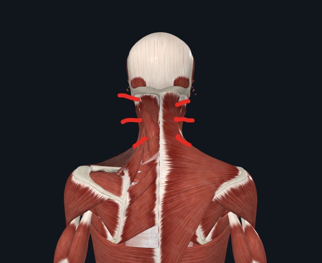 douleur cervicale